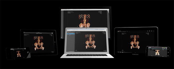 Le capacità di collaborazione offerte da ResolutionMD permettono a più medici di partecipare alla stessa sessione di imaging. Le capacità di collaborazione offerte da ResolutionMD permettono a più medici di partecipare alla stessa sessione di imaging.