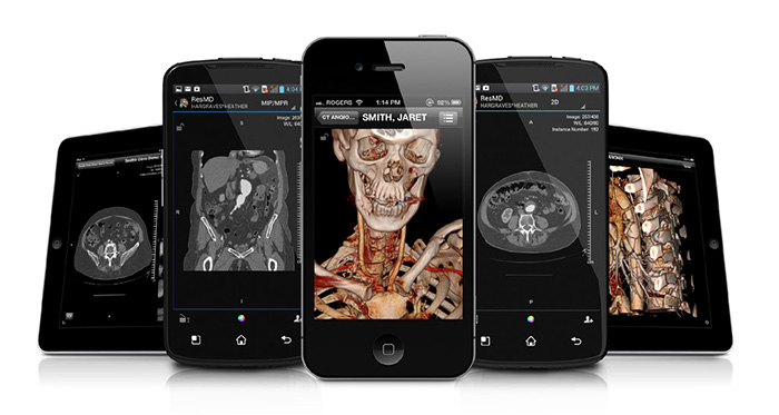 Radiologi e medici refertatori possono usare i propri dispositivi mobili per accedere a un server ResolutionMD a base Quadro per visualizzare immagini mediche, e renderizzare interattivamente modelli 3D di tomografie computerizzate in tempo reale. Radiologi e medici refertatori possono usare i propri dispositivi mobili per accedere a un server ResolutionMD a base Quadro per visualizzare immagini mediche, e renderizzare interattivamente modelli 3D di tomografie computerizzate in tempo reale.