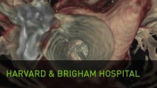 Harvard & Bigham Hospital: Placche 