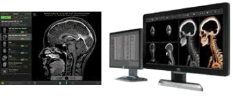 Accesso mobile via Visage Easesm, basato su Visage 7 (sinistra) e Visage 7 Enterprise Imaging Platform (destra). Immagine cortesemente offerta da Visage Imaging Accesso mobile via Visage Easesm, basato su Visage 7 (sinistra) e Visage 7 Enterprise Imaging Platform (destra). Immagine cortesemente offerta da Visage Imaging