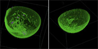Rendering volumetrico realizzato dal sistema TechniScan Whole Breast Ultrasound.